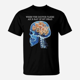 Take An X Ray Of My Head T-Shirt - Monsterry AU